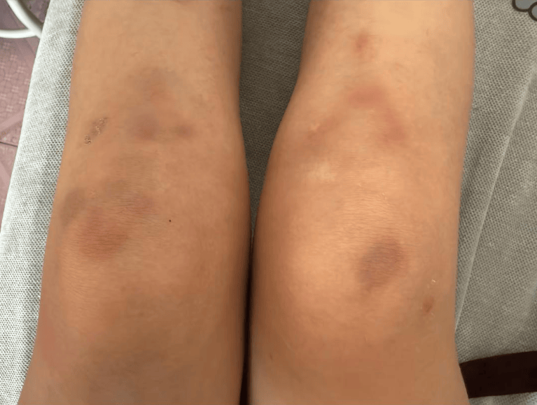 皇冠信用代理_女子自称因工资问题被老板锁办公室里打 警方：双方已到派出所皇冠信用代理，是否打人还在调查